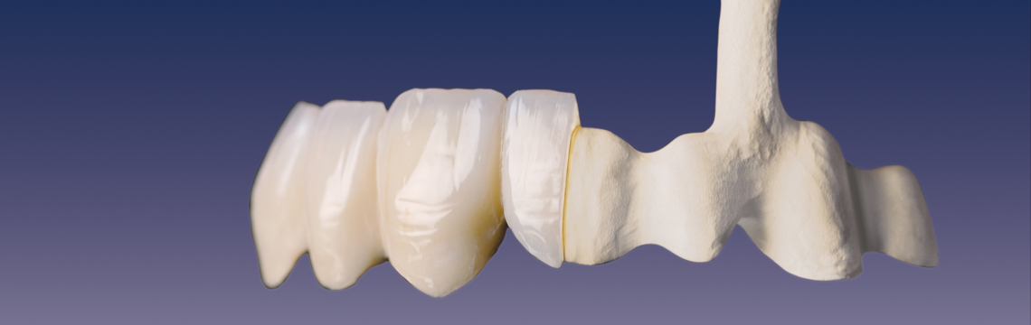 banner-images-dental-ceramics
