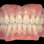 banner-images-dentures-removables